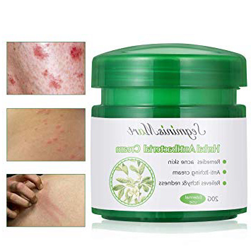 Crema a base di erbe naturale, crema a rilievo per il prurito, creme antibatteriche a base di erbe cinesi